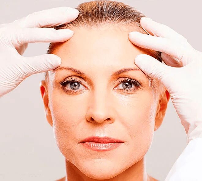 لیفت شقیقه با بهترین جراح برای کشیدن شقیقه بهترین جراح لیفت شقیقه مزایای بهترین جراح لیفت شقیقه در کلینیک جراحی زیبایی دکتر شمس