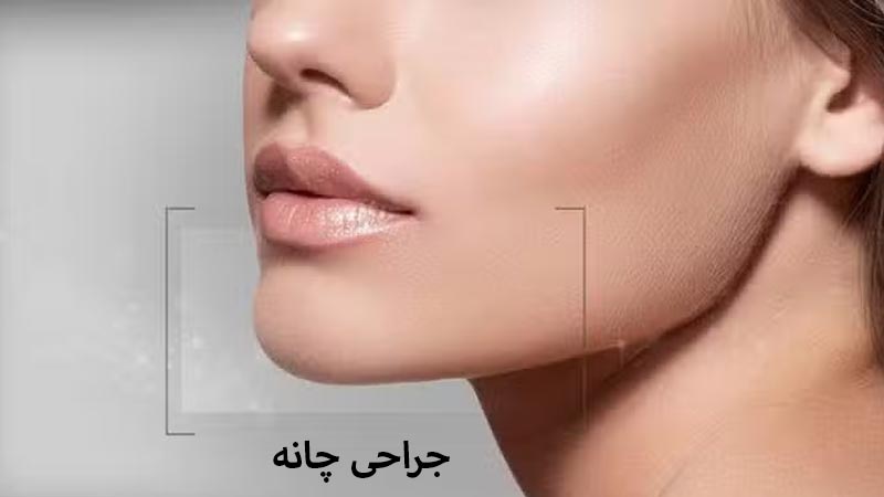 جدول هزینه عمل جنیوپلاستی به دلار هزینه عمل جنیوپلاستی به دلار هزینه عمل جنیوپلاستی به تومان
