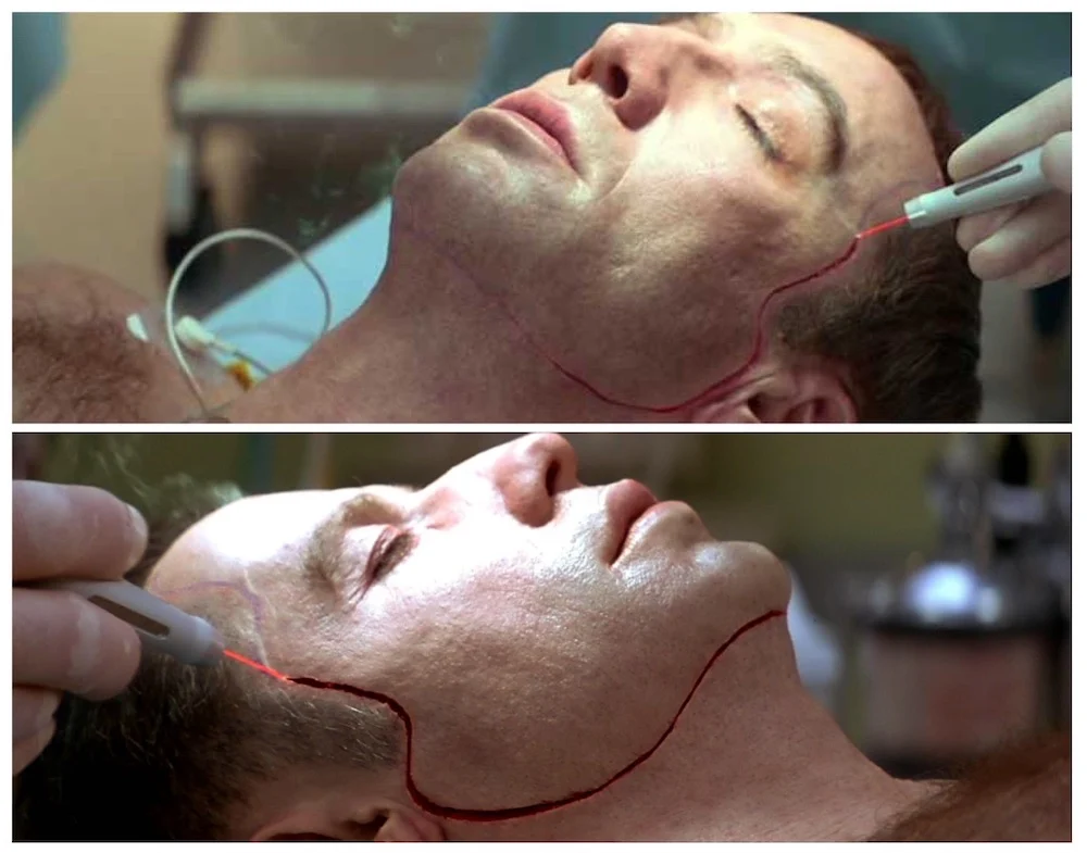 حقایق پزشکی فیلم face/off از نظر جراح زیبایی فیلم face/off بررسی فیلم face/off از نظر دکتر شاهین شمس متخصص جراح زیبایی