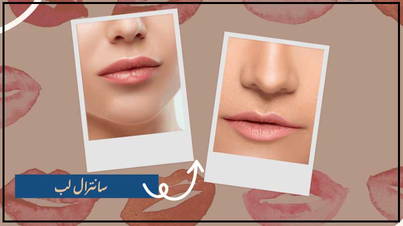 آشنایی کامل سانترال لب سانترال لب دلیل انجام لیفت لب یا سانترال لب