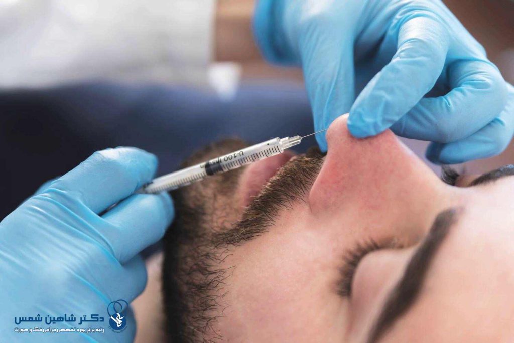 فیلر بینی چیست (ترمیم بینی با تزریق ژل بدون نیاز به جراحی) فیلر بینی معایب و عوارض احتمالی فیلر بینی