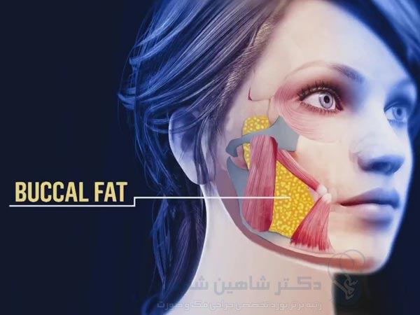 مزایا انجام بوکال فت