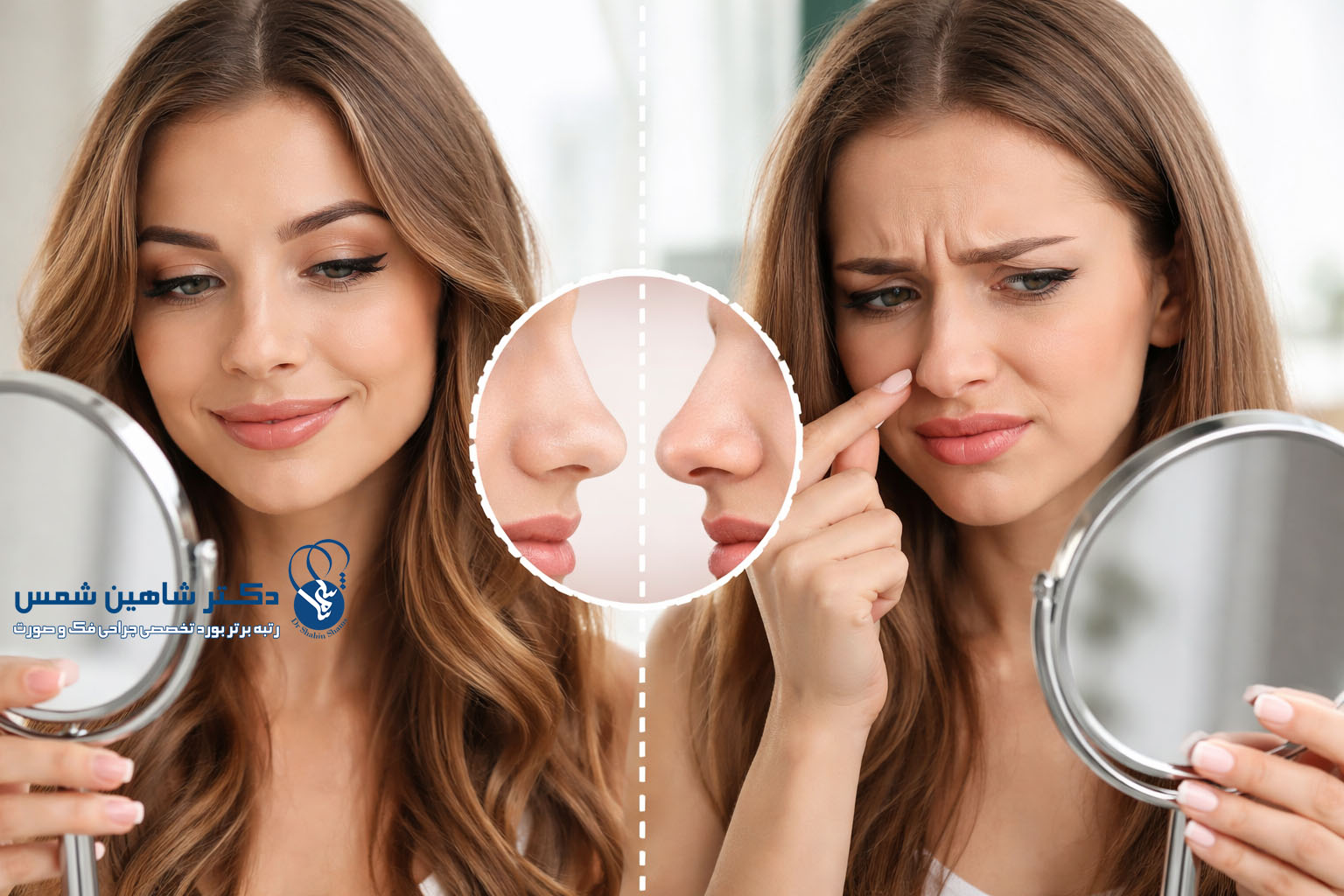 کدام فرم‌های بینی در عکس خوب‌اند ولی در واقعیت نه؟