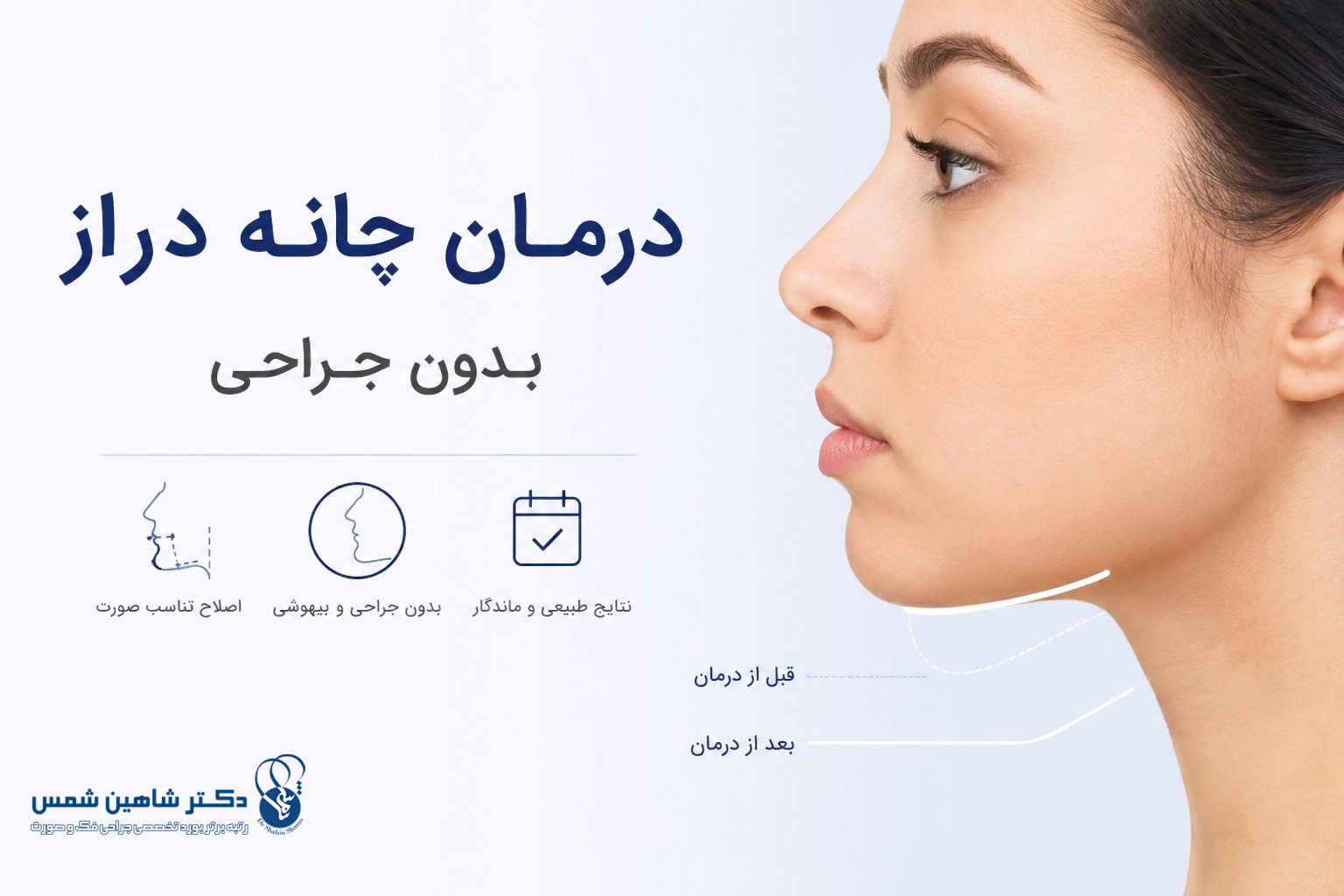 درمان چانه دراز بدون جراحی