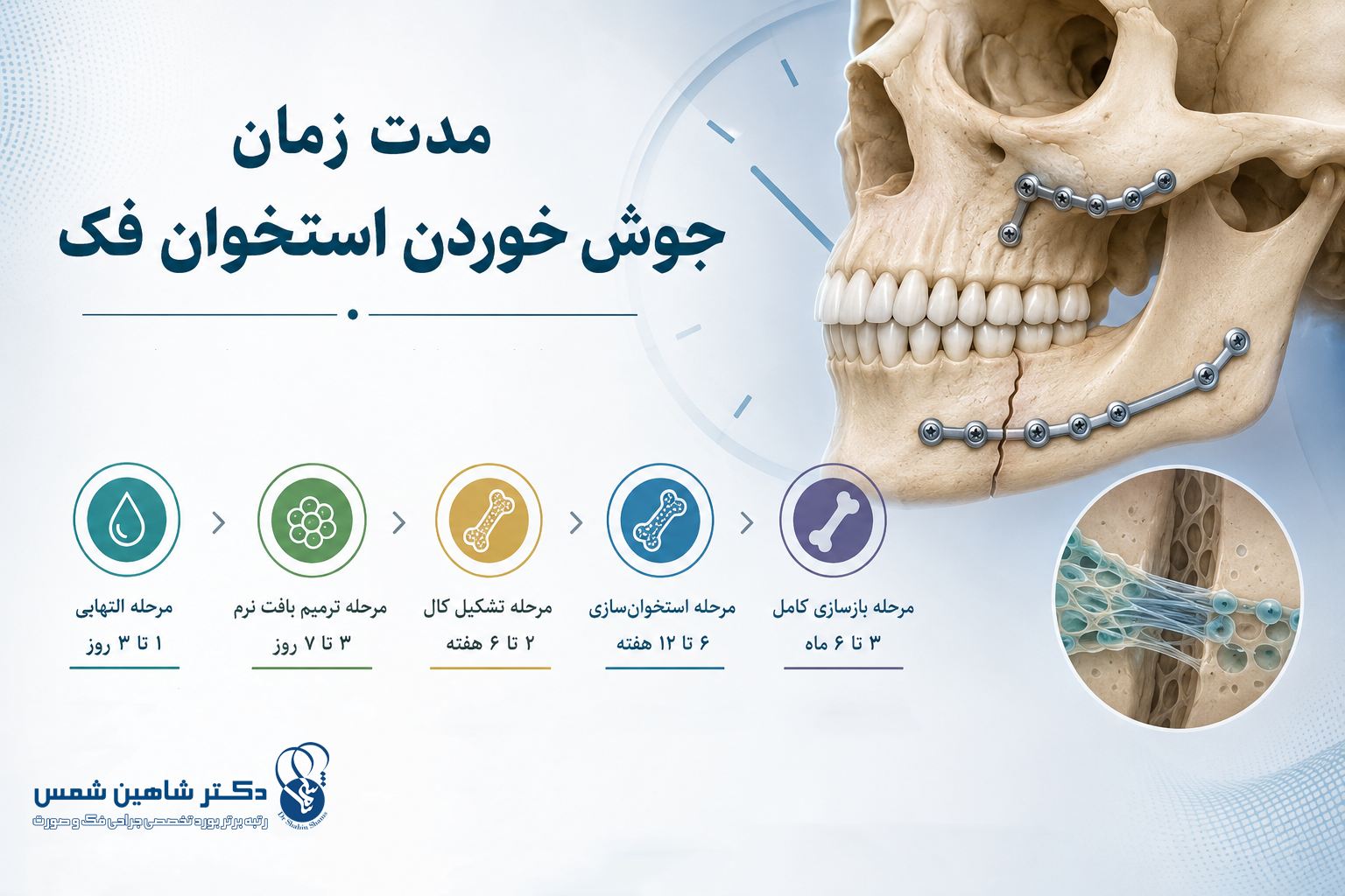 مدت زمان جوش خوردن استخوان فک